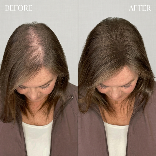 PDRN Scalp Serum